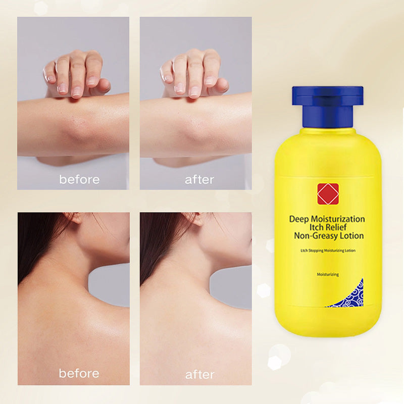 Skin Savior™ — Instantly Soothes and Revives Even the Dryest, Itchiest Skin