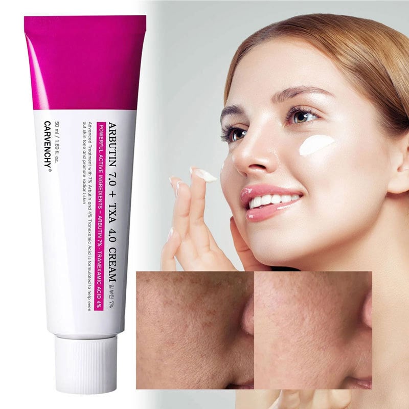 Arbutin Radiance™ — Cancella le macchie scure rapidamente per una pelle che splende di fiducia