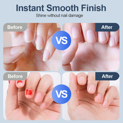 NailMaster™ — Moeiteloze, Perfecte Nagels Altijd Binnen Handbereik