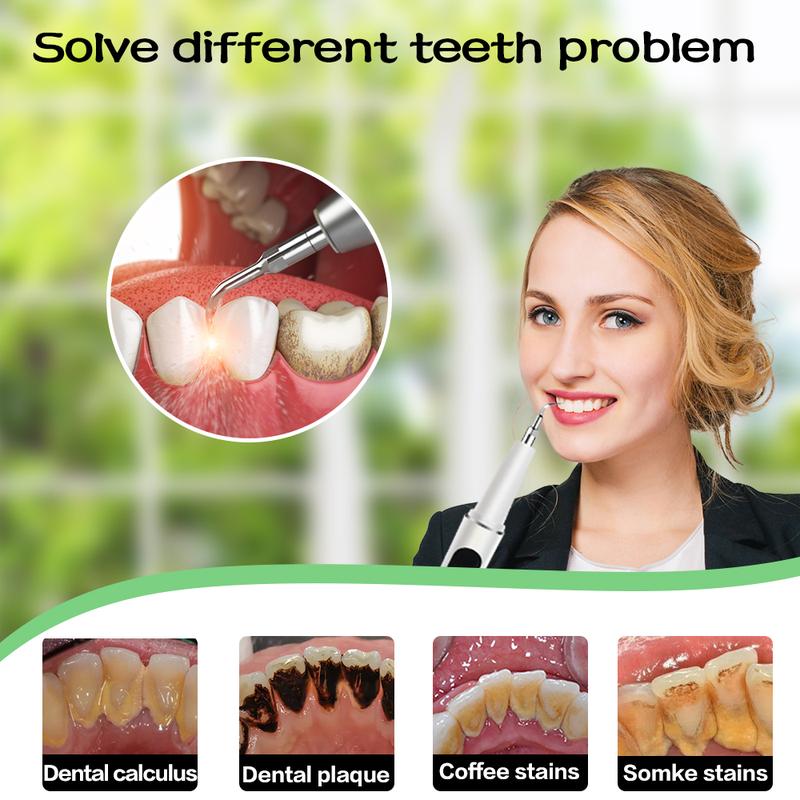 SmileSonic™ — Blast Away Stubborn Stains for a Jaw-Dropping Glow