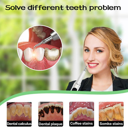 SmileSonic™ — Blast Away Stubborn Stains for a Jaw-Dropping Glow