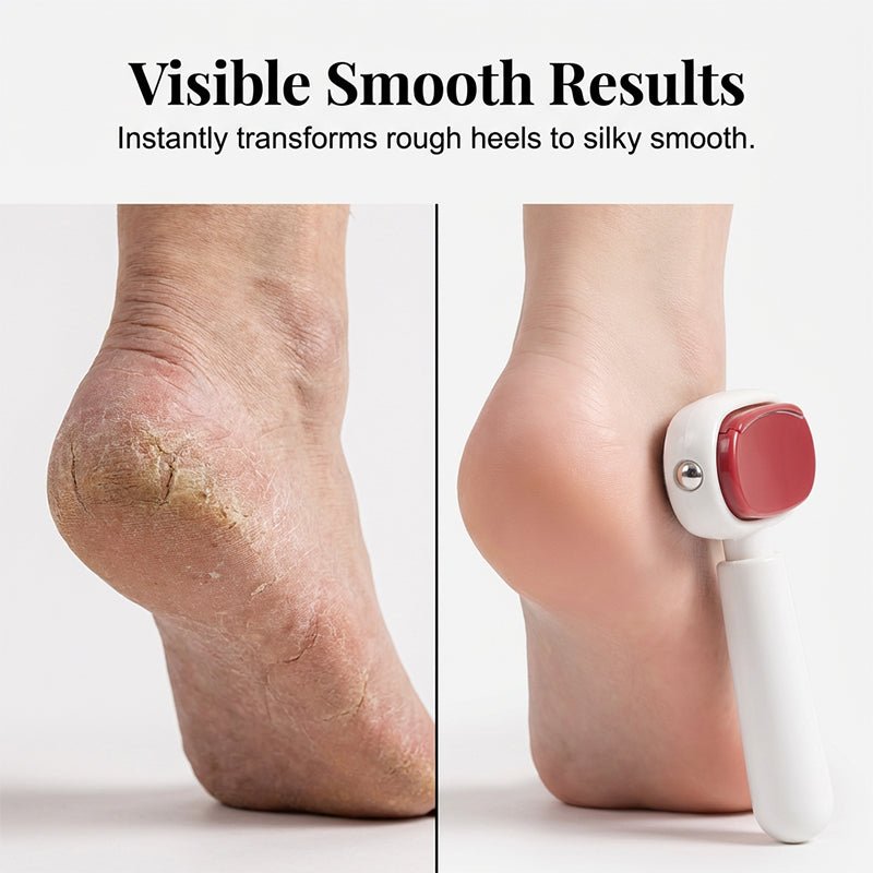 DuraSmooth Foot Scraper Tool | Stainless Steel Callus File Remover, Dual-Surface Design 2