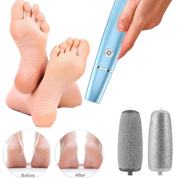 SilkStep Pro Foot Care Device | Electric Callus Remover, USB Rechargeable 4