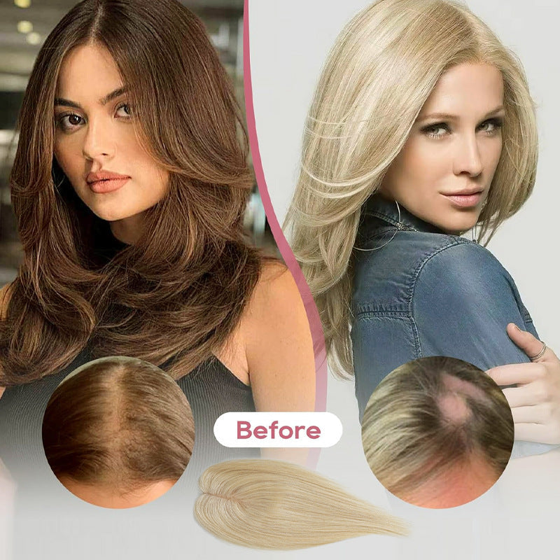 Wina Hair Topper | 100% Remy Human Hair for Women, Lightweight and Customizable Fit 1