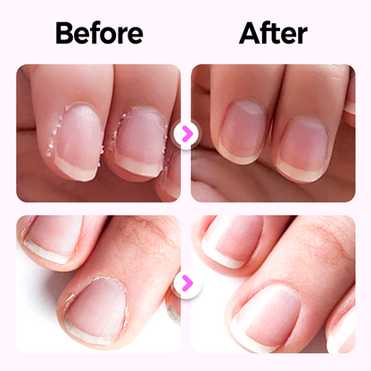 Lipicare™ — Flaunt Flawless Nails That Command Attention Instantly