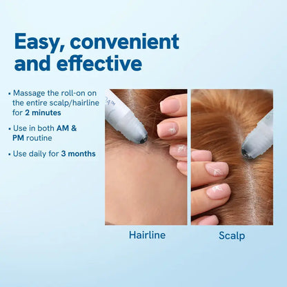 StrandRevive™ — Ignite Hidden Follicles for a Voluminous, Unbreakable Mane