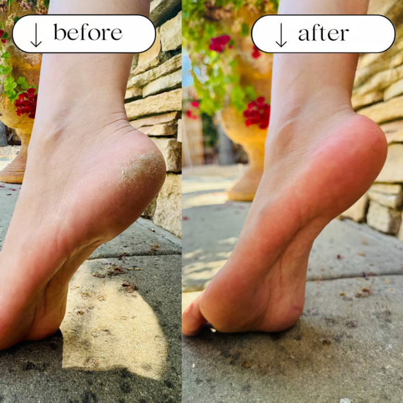SmoothStep — Nano-Glass Foot File for Soft, Smooth Feet