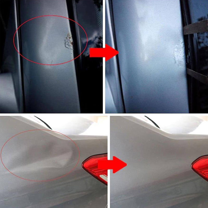Kit de reparo de amassados com barra em T Dentaway™